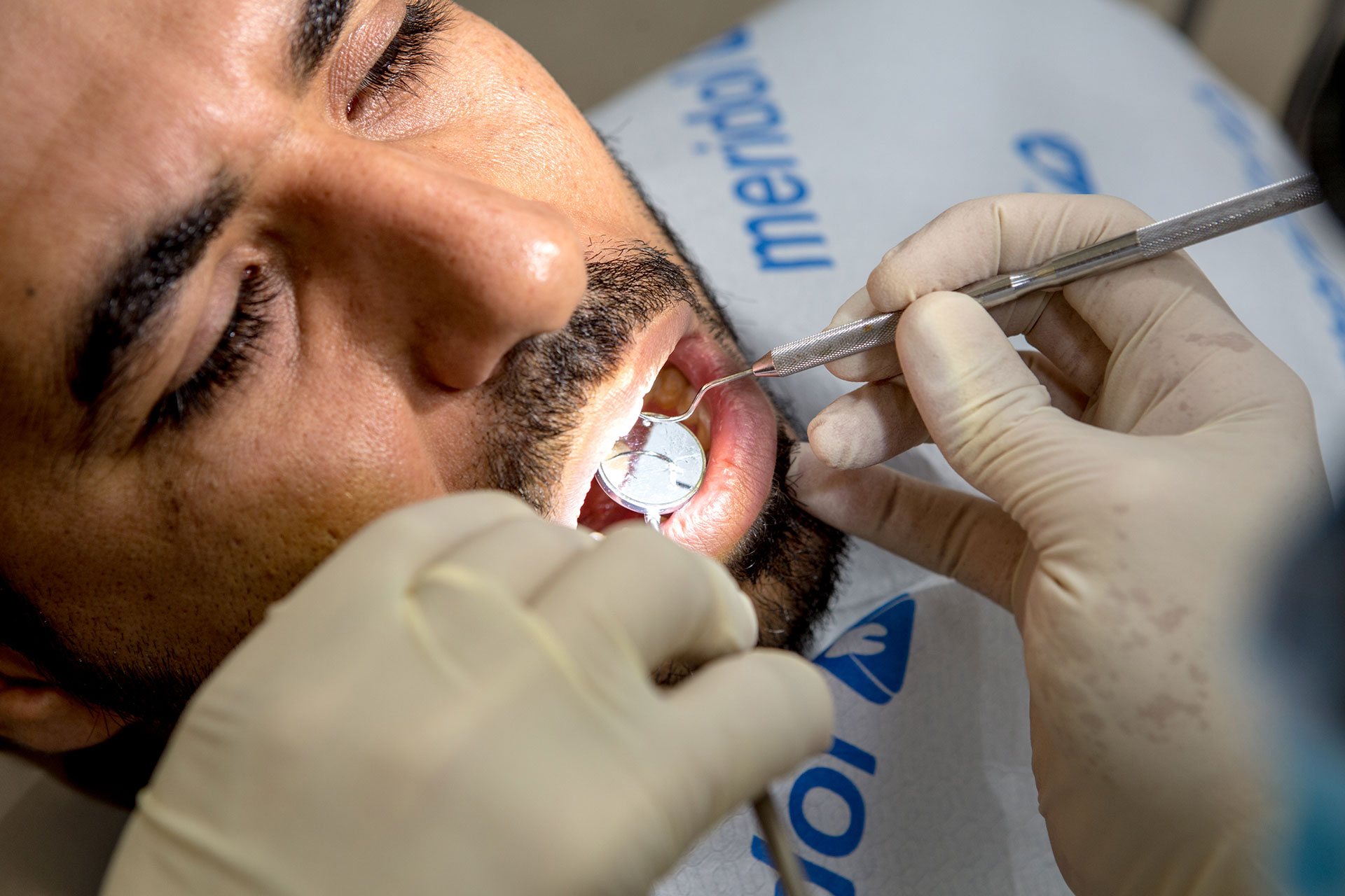 טיפולי שורש -וינטרמן - שתלים, רפואה וטכנאות שיניים בחיפה