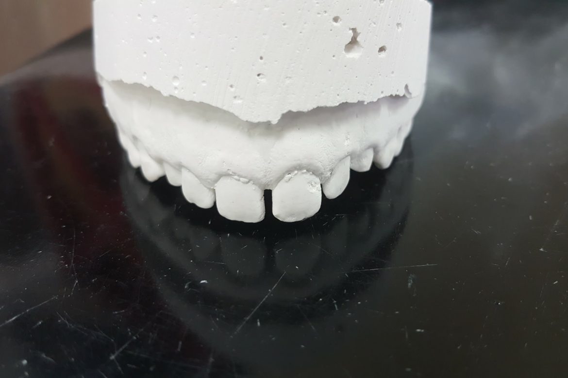 וינטרמן רפואה וטכנאות שיניים - מודל גבס