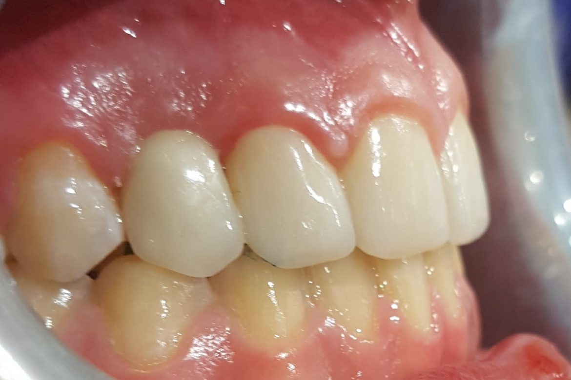 וינטרמן רפואה וטכנאות שיניים - תוצאה סופית