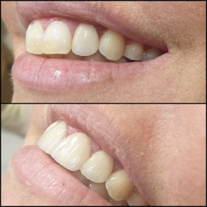 קליניקת וינטרמן - ציפוי חרסינה