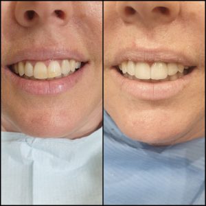 קליניקת וינטרמן - ציפוי חרסינה